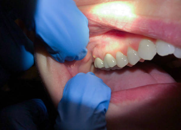 Best After-Hours Dental Care in Dodson Branch, TN